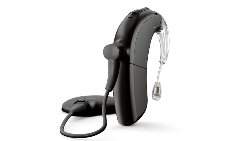 REHABILITACIJA ODRASLIH OSOBA S KOHLEARNIM IMPLANTOM